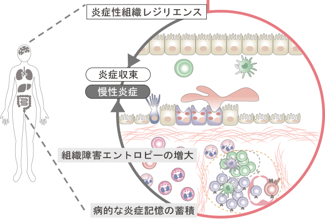 炎症性組織レジリエンスの機能・破綻の全容解明